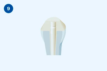 Применение Люксакор Z Дуал Смартмикс - этап 9